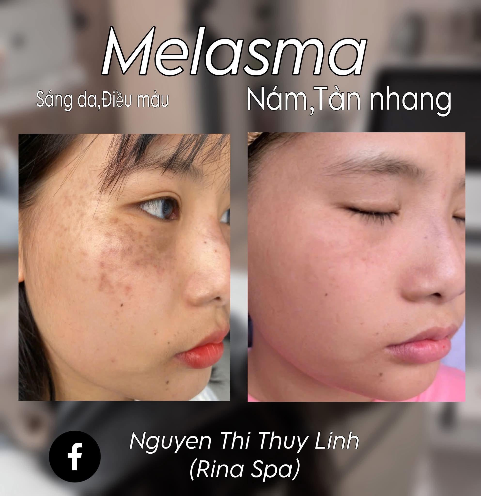 Rina Beauty Spa service image