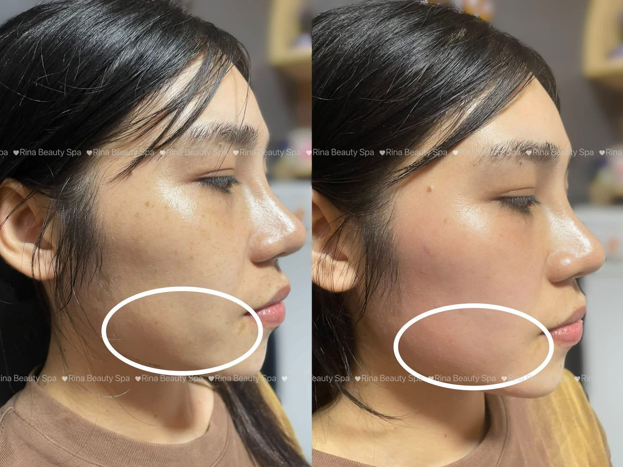 Rina Beauty Spa service image