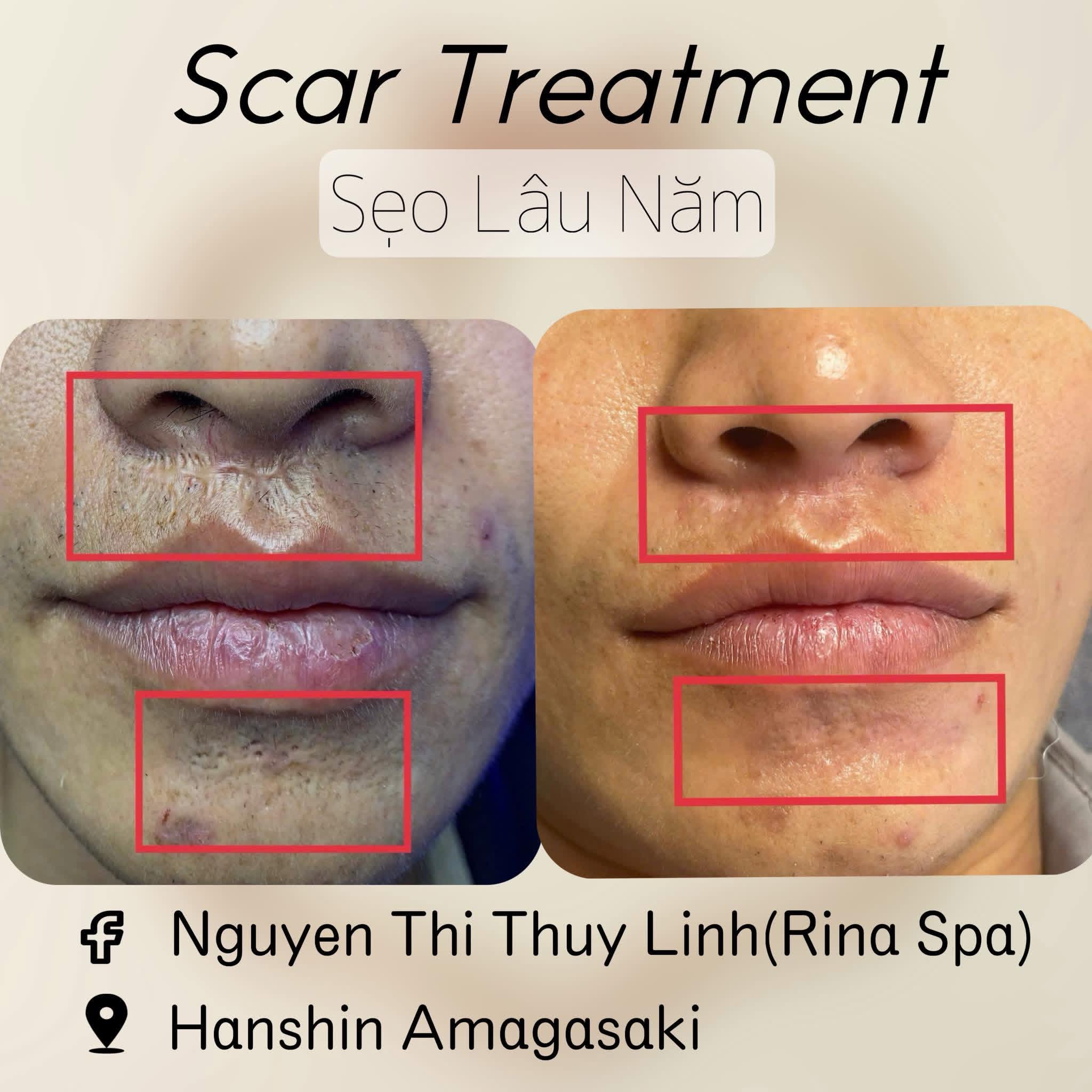 Rina Beauty Spa service image