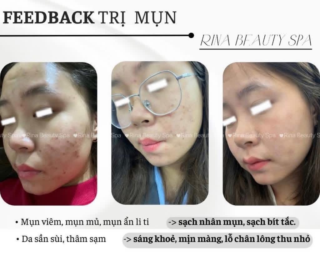 Rina Beauty Spa service image