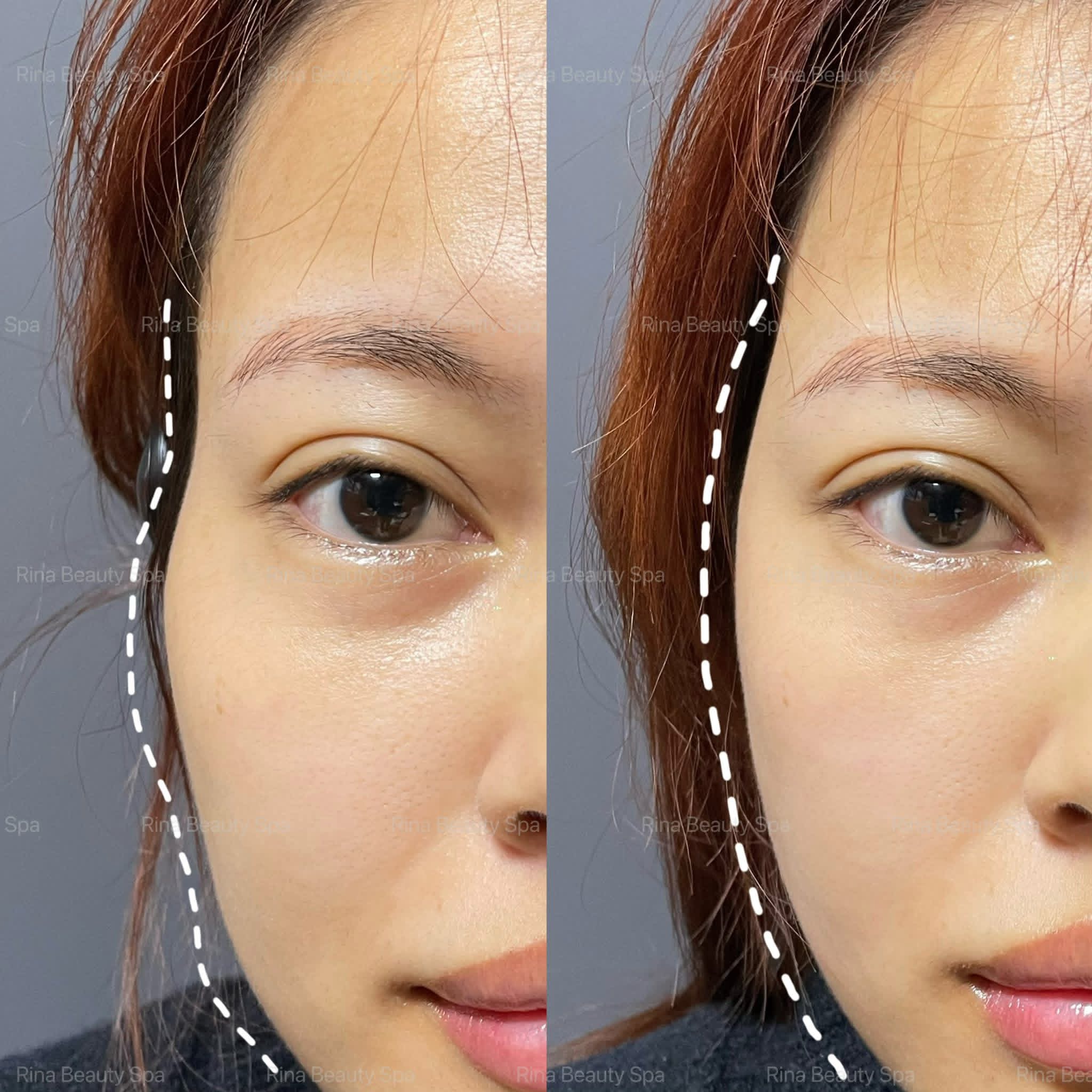 Rina Beauty Spa service image