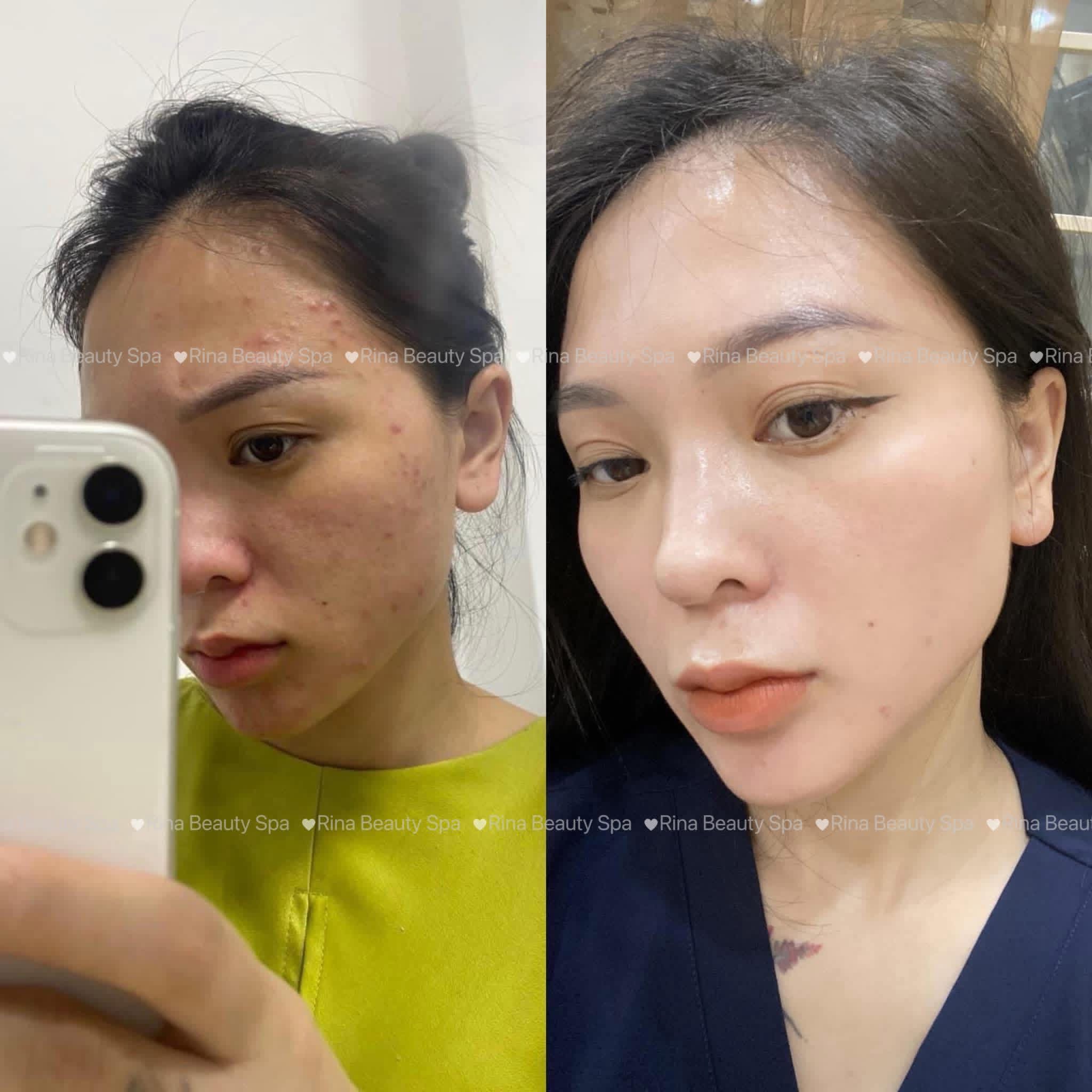 Rina Beauty Spa service image