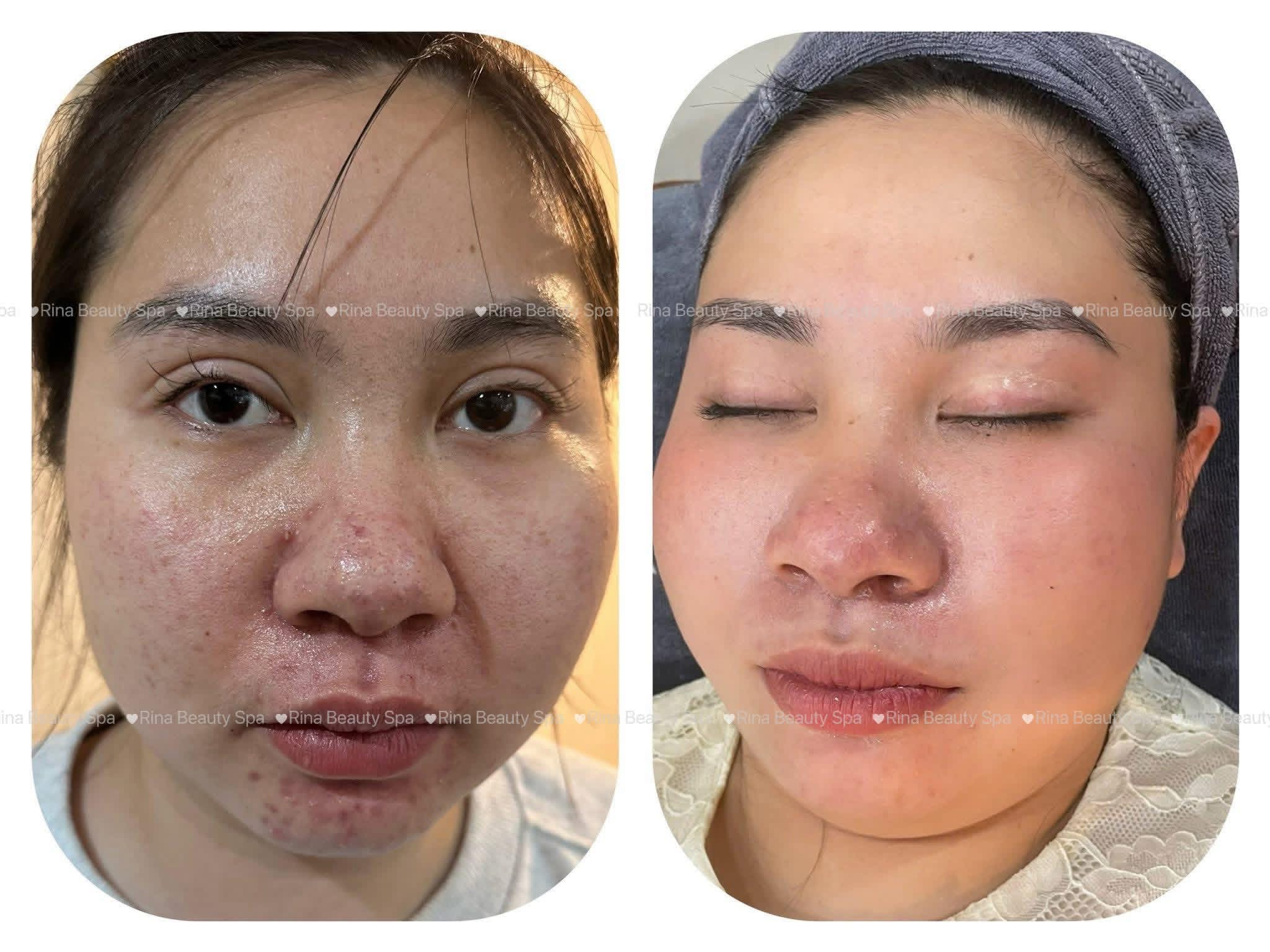 Rina Beauty Spa service image