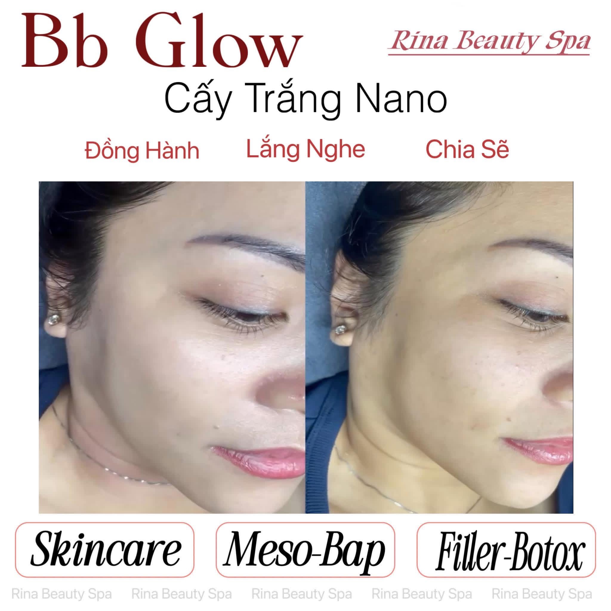 Rina Beauty Spa service image